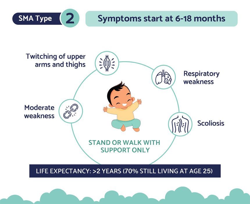 Type 2 sma